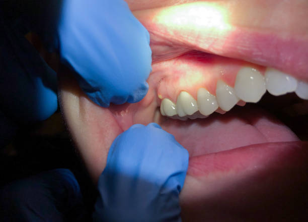 Best Pediatric Emergency Dentist in Chenoweth, OR