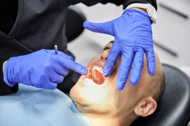 Best Emergency Dental Extractions in Chenoweth, OR